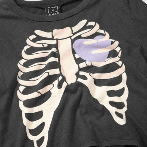 Itchy Bones T-shirt